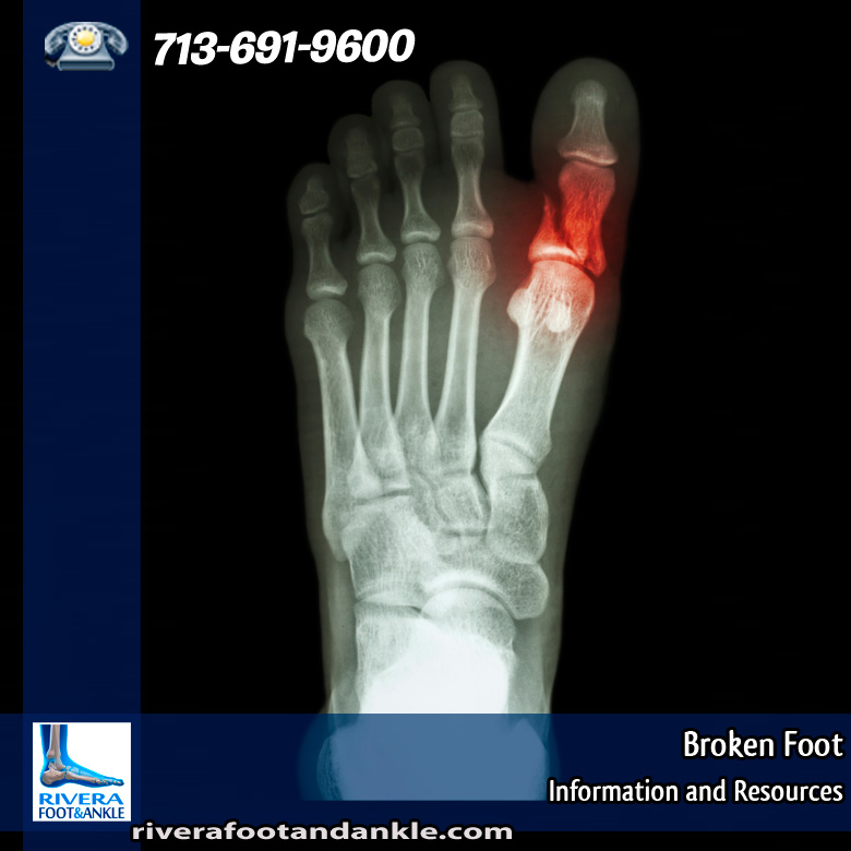 25-broken-foot