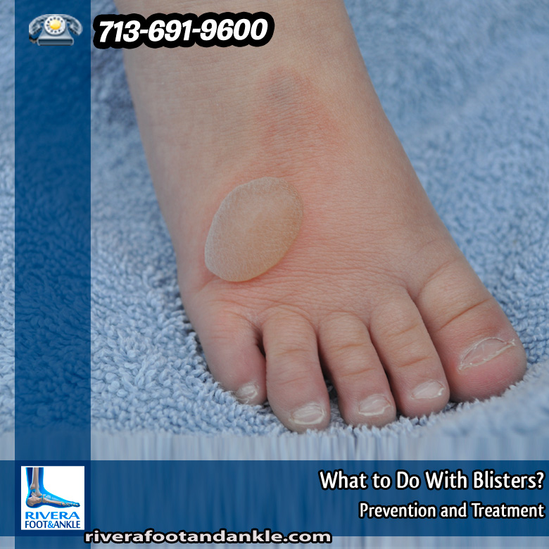 29-what-to-do-with-blisters