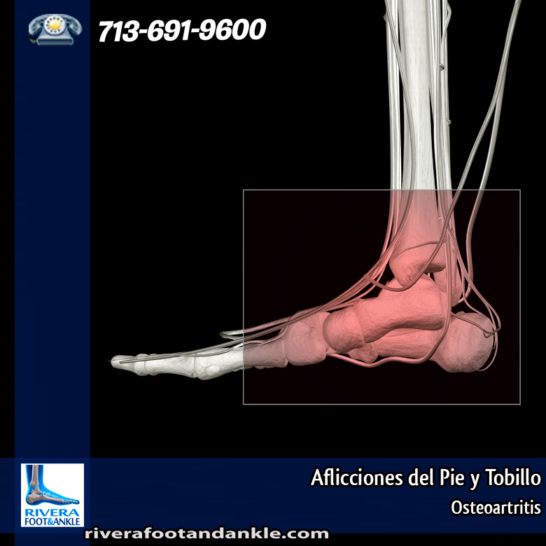24-afliciones-del-pie-y-tobillo